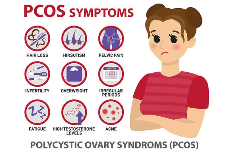 Polycystic Ovarian Syndrome – Series 2